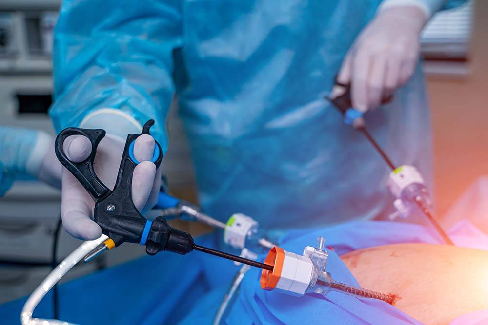 Laparoscopic Instruments