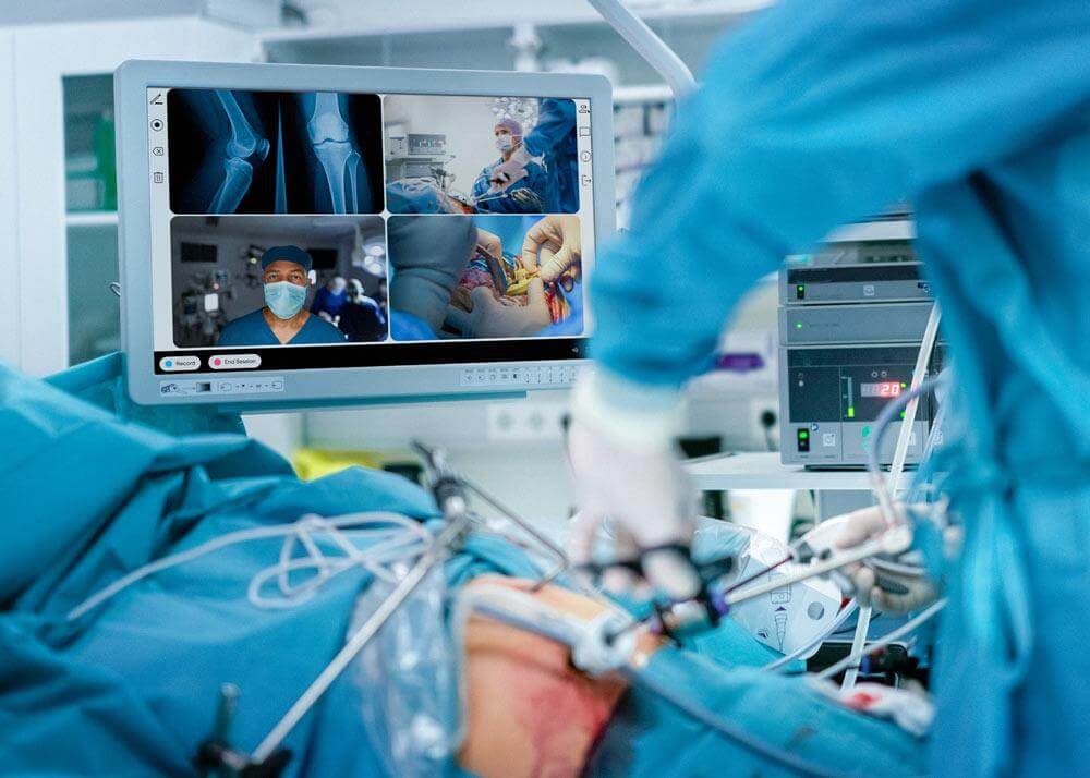 Laparoscopic Cameras - Vishal Surgical Co
